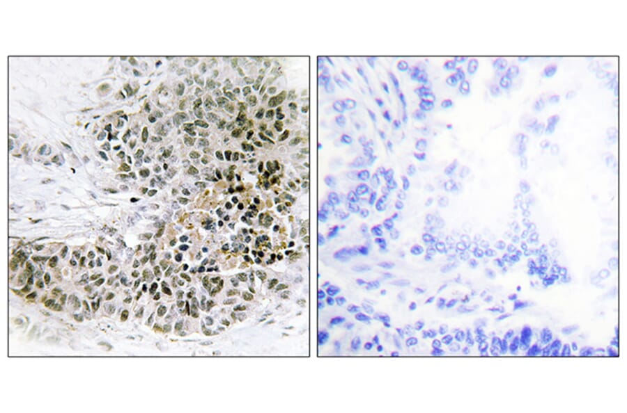 Immunohistochemistry - Anti-TRPS1 Antibody (C11843) - Antibodies.com