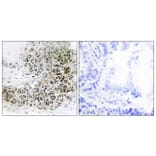 Immunohistochemistry - Anti-TRPS1 Antibody (C11843) - Antibodies.com