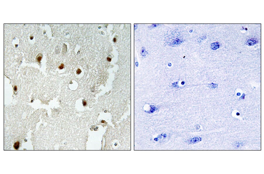 Immunohistochemistry - Anti-TREF1 Antibody (C11526) - Antibodies.com