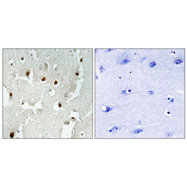 Immunohistochemistry - Anti-TREF1 Antibody (C11526) - Antibodies.com