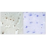 Immunohistochemistry - Anti-TREF1 Antibody (C11526) - Antibodies.com