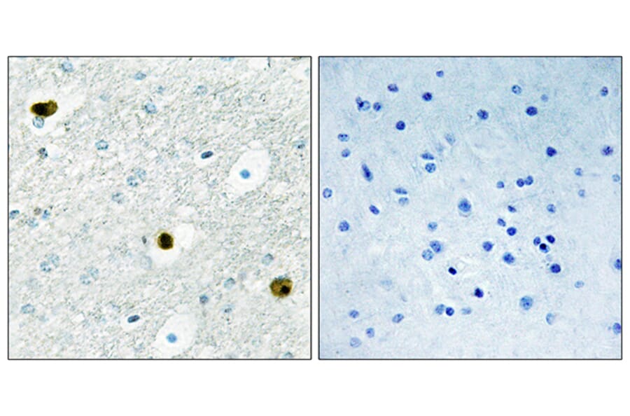 Immunohistochemistry - Anti-TPD52 Antibody (C10745) - Antibodies.com