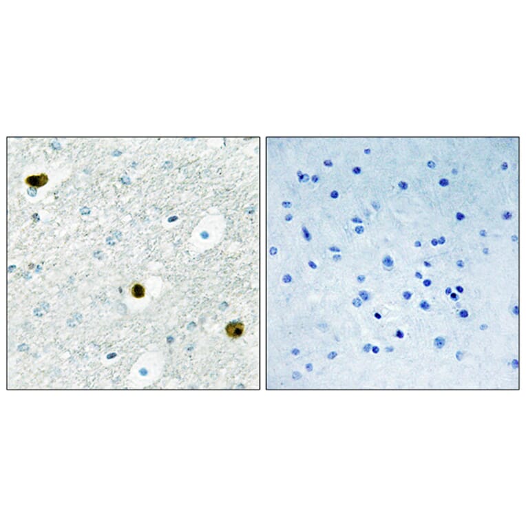 Immunohistochemistry - Anti-TPD52 Antibody (C10745) - Antibodies.com