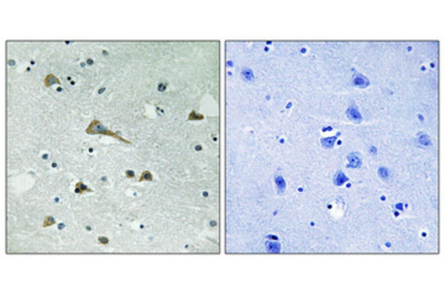 Immunohistochemistry - Anti-TIRAP Antibody (B8435) - Antibodies.com
