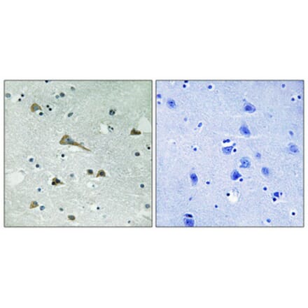 Immunohistochemistry - Anti-TIRAP Antibody (B8435) - Antibodies.com