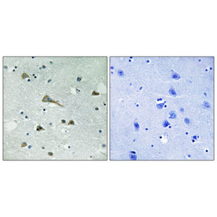 Immunohistochemistry - Anti-TIRAP Antibody (B8435) - Antibodies.com