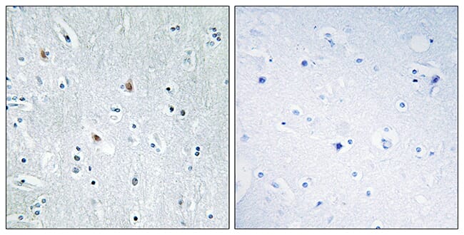 Immunohistochemical analysis of paraffin-embedded human brain tissue using Anti-SOX12 Antibody. The right hand panel represents a negative control, where the antibody was pre-incubated with the immunising peptide.