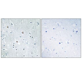 Immunohistochemistry - Anti-SOX12 Antibody (C10082) - Antibodies.com