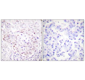 Immunohistochemistry - Anti-SENP3 Antibody (C0367) - Antibodies.com