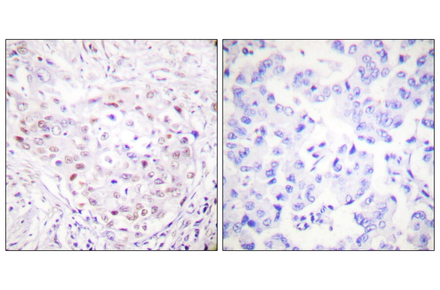 Immunohistochemistry - Anti-SENP3 Antibody (C0367) - Antibodies.com