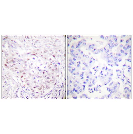 Immunohistochemistry - Anti-SENP3 Antibody (C0367) - Antibodies.com