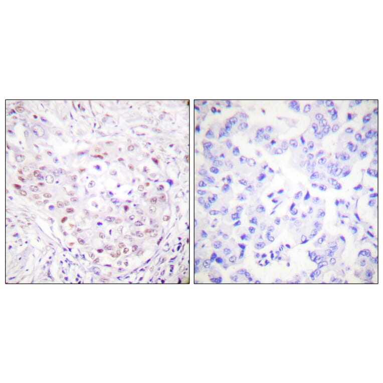 Immunohistochemistry - Anti-SENP3 Antibody (C0367) - Antibodies.com