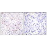 Immunohistochemistry - Anti-SENP3 Antibody (C0367) - Antibodies.com