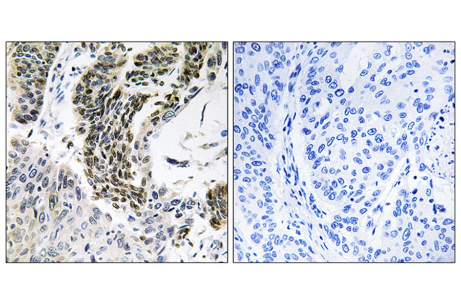 Immunohistochemistry - Anti-RREB1 Antibody (C18285) - Antibodies.com