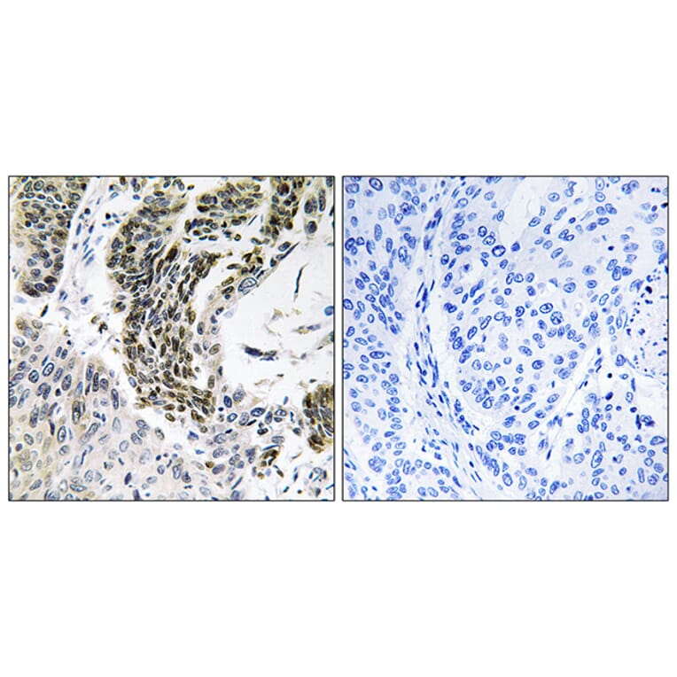 Immunohistochemistry - Anti-RREB1 Antibody (C18285) - Antibodies.com