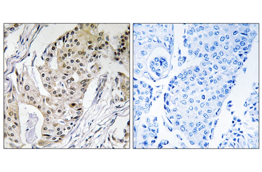 Immunohistochemistry - Anti-POLE4 Antibody (C15412) - Antibodies.com