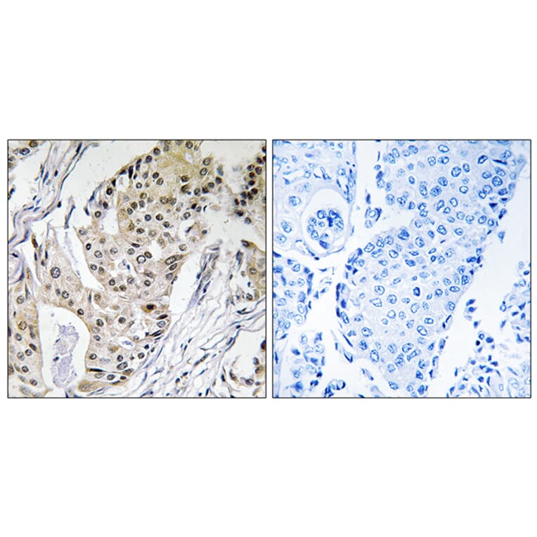 Immunohistochemistry - Anti-POLE4 Antibody (C15412) - Antibodies.com