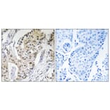 Immunohistochemistry - Anti-POLE4 Antibody (C15412) - Antibodies.com