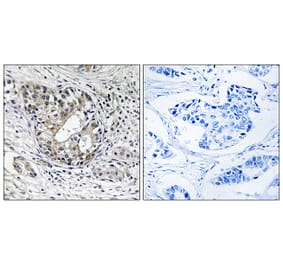 Immunohistochemistry - Anti-PNPT1 Antibody (C17774) - Antibodies.com