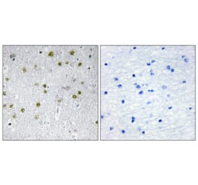 Immunohistochemistry - Anti-NRIP2 Antibody (C11598) - Antibodies.com