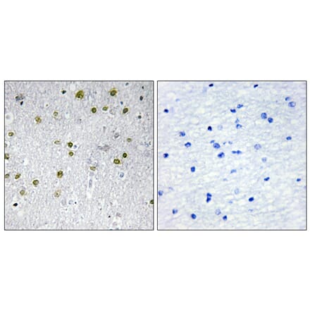 Immunohistochemistry - Anti-NRIP2 Antibody (C11598) - Antibodies.com