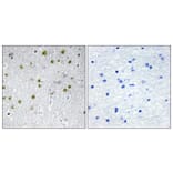 Immunohistochemistry - Anti-NRIP2 Antibody (C11598) - Antibodies.com
