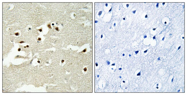 Immunohistochemical analysis of paraffin-embedded human brain tissue using Anti-NCOA5 Antibody. The right hand panel represents a negative control, where the antibody was pre-incubated with the immunising peptide.