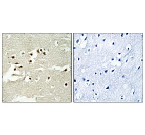 Immunohistochemistry - Anti-NCOA5 Antibody (C17115) - Antibodies.com