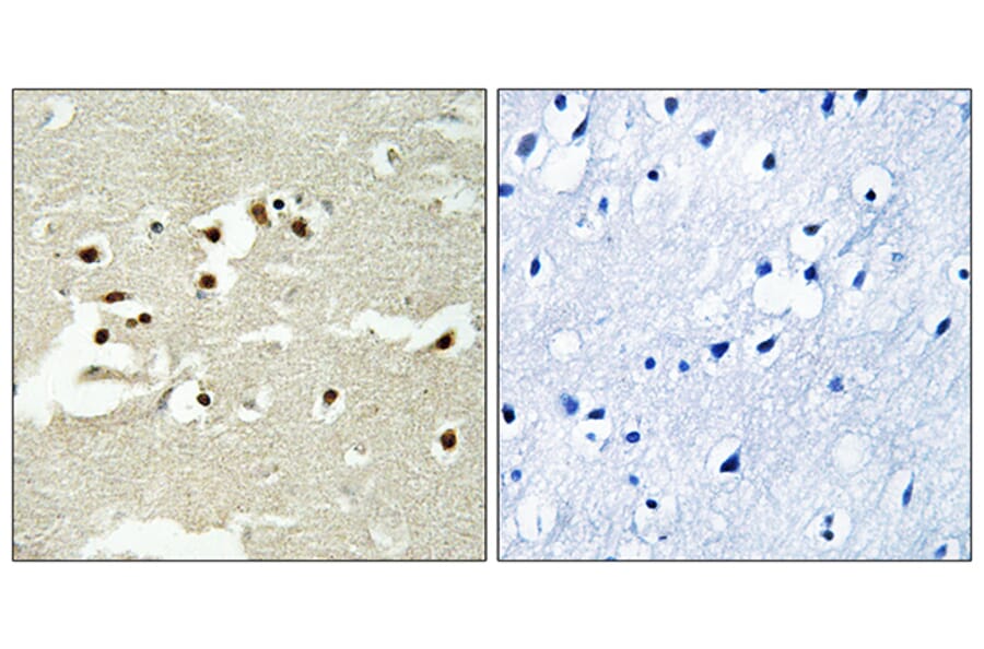 Immunohistochemistry - Anti-NCOA5 Antibody (C17115) - Antibodies.com