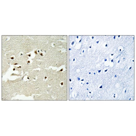 Immunohistochemistry - Anti-NCOA5 Antibody (C17115) - Antibodies.com