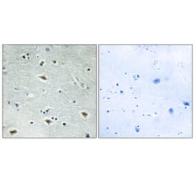 Immunohistochemistry - Anti-MTG16 Antibody (C10912) - Antibodies.com