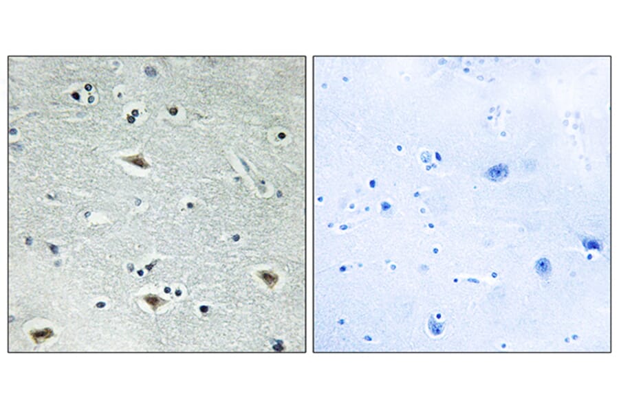 Immunohistochemistry - Anti-MTG16 Antibody (C10912) - Antibodies.com