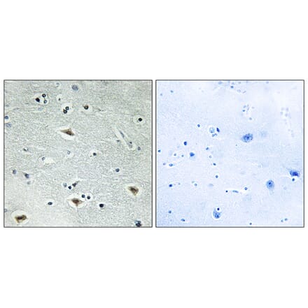 Immunohistochemistry - Anti-MTG16 Antibody (C10912) - Antibodies.com