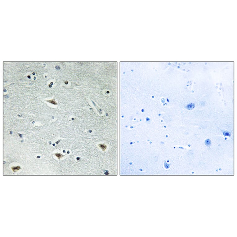 Immunohistochemistry - Anti-MTG16 Antibody (C10912) - Antibodies.com