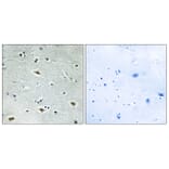 Immunohistochemistry - Anti-MTG16 Antibody (C10912) - Antibodies.com