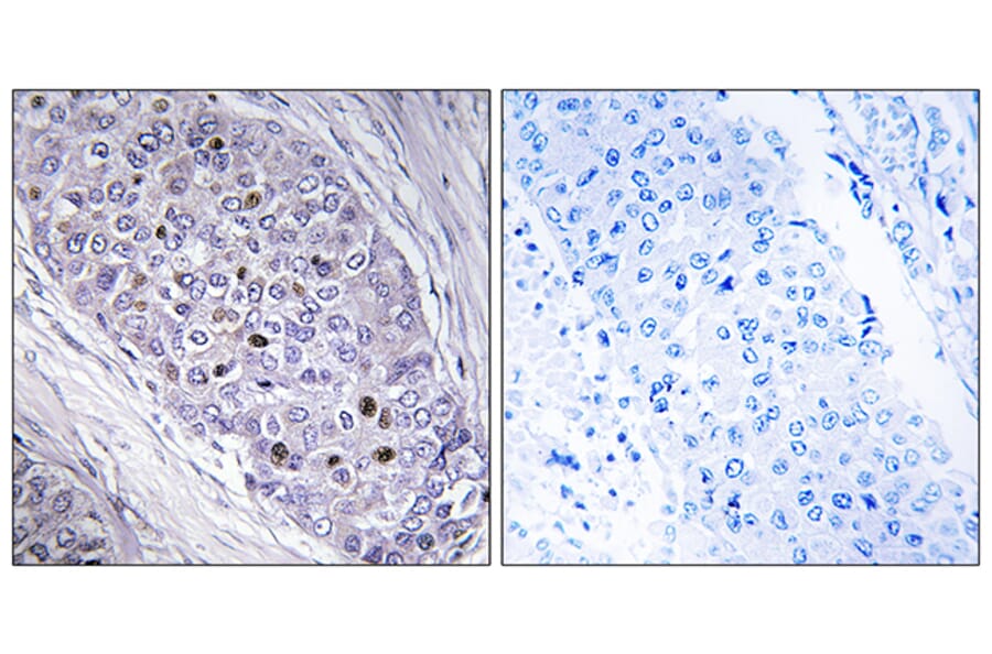 Immunohistochemistry - Anti-MEF2C Antibody (C10891) - Antibodies.com