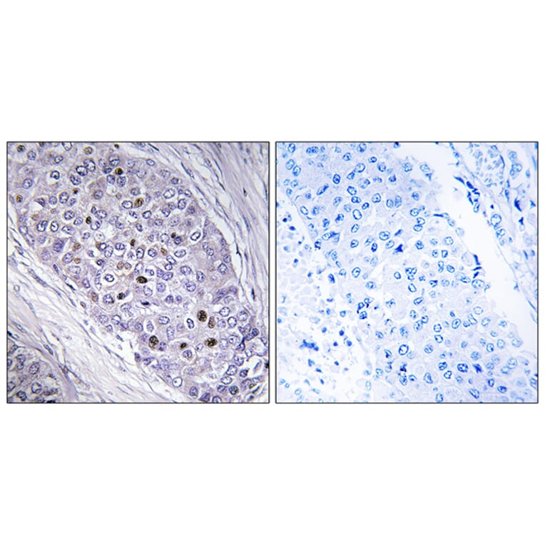 Immunohistochemistry - Anti-MEF2C Antibody (C10891) - Antibodies.com