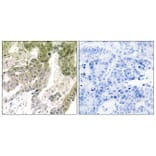 Immunohistochemistry - Anti-LAMA5 Antibody (C13068) - Antibodies.com