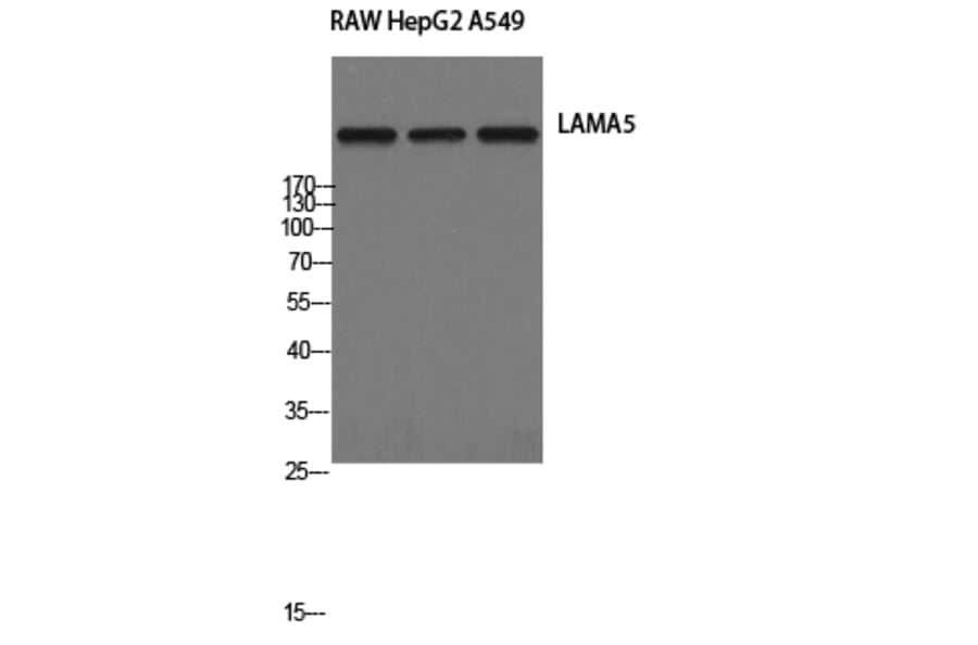 Western Blot - Anti-LAMA5 Antibody (C13068) - Antibodies.com