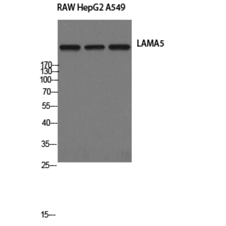 Western Blot - Anti-LAMA5 Antibody (C13068) - Antibodies.com