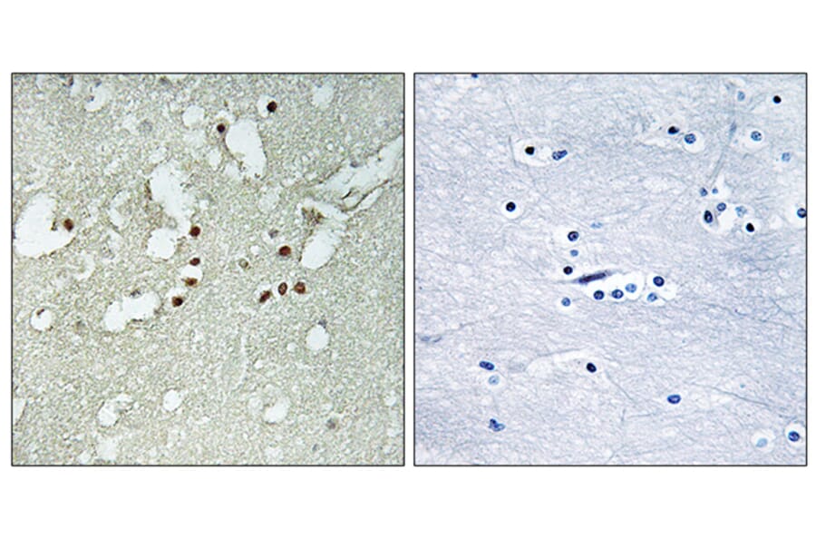 Immunohistochemistry - Anti-FOXJ3 Antibody (C15789) - Antibodies.com