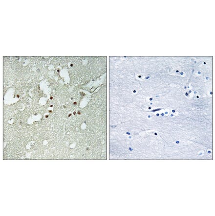 Immunohistochemistry - Anti-FOXJ3 Antibody (C15789) - Antibodies.com