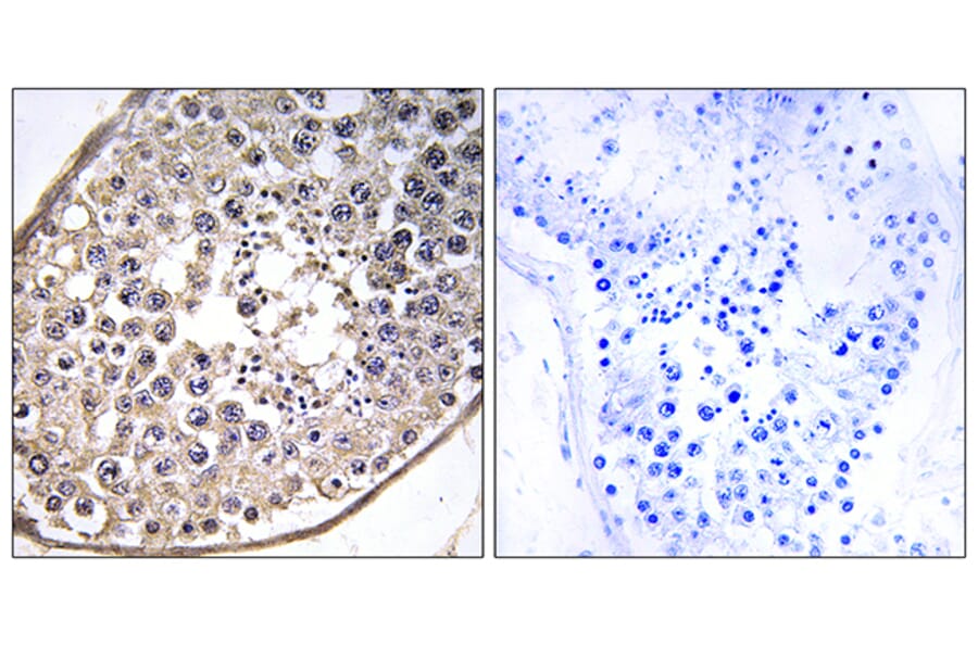 Immunohistochemistry - Anti-DNAL4 Antibody (C15515) - Antibodies.com