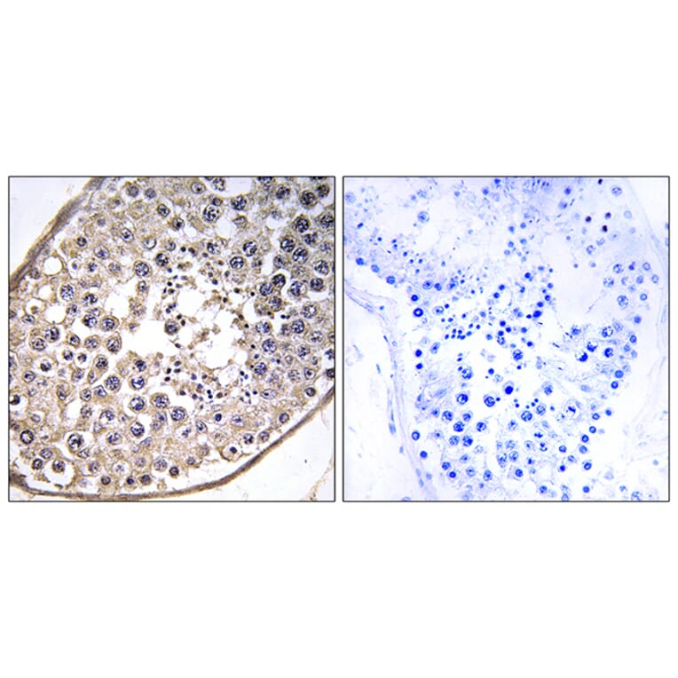 Immunohistochemistry - Anti-DNAL4 Antibody (C15515) - Antibodies.com