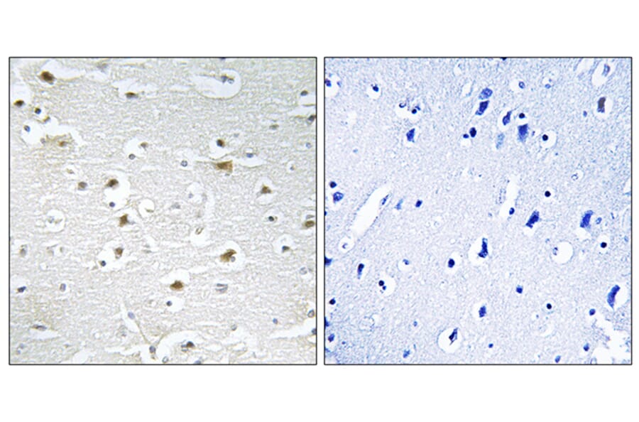 Immunohistochemistry - Anti-DDX3Y Antibody (C14653) - Antibodies.com
