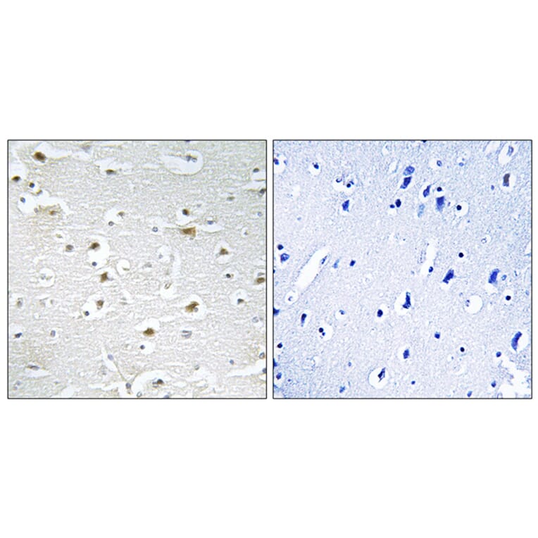 Immunohistochemistry - Anti-DDX3Y Antibody (C14653) - Antibodies.com