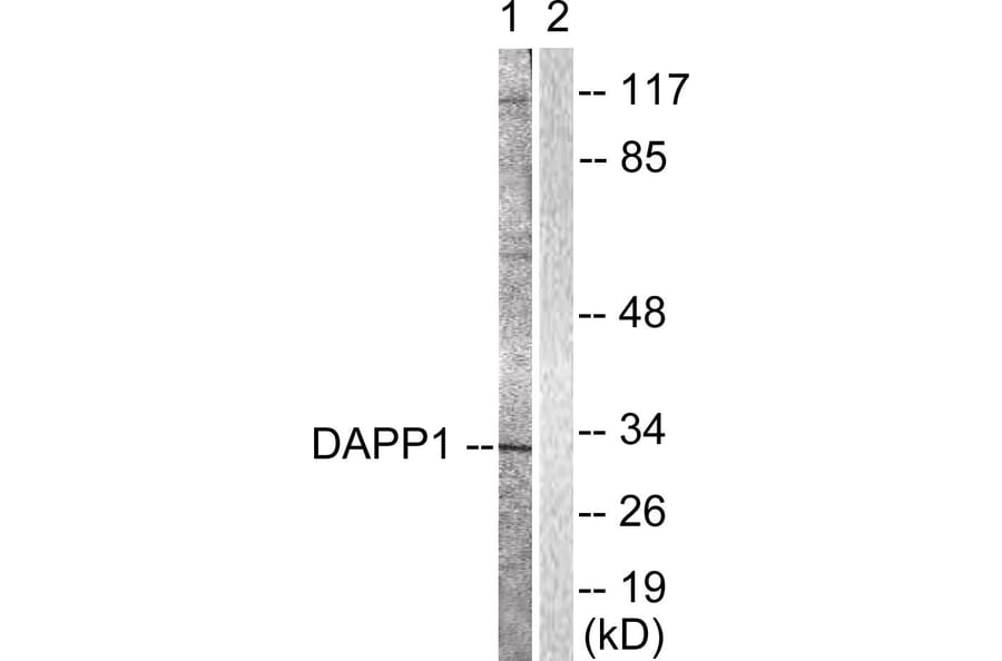 Western Blot - Anti-DAPP1 Antibody (B0901) - Antibodies.com