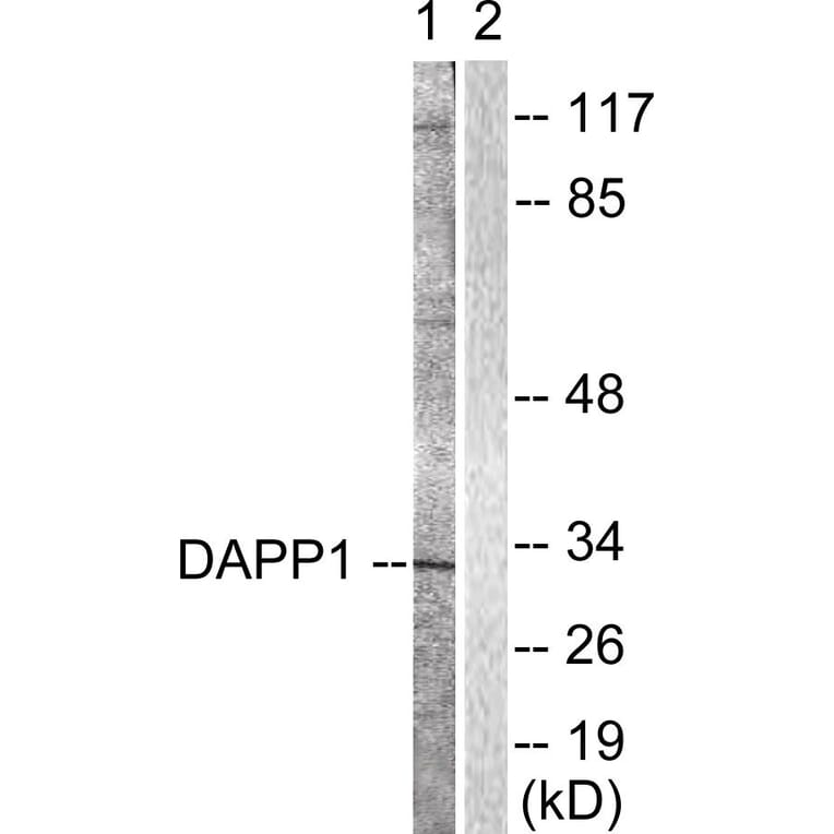 Western Blot - Anti-DAPP1 Antibody (B0901) - Antibodies.com