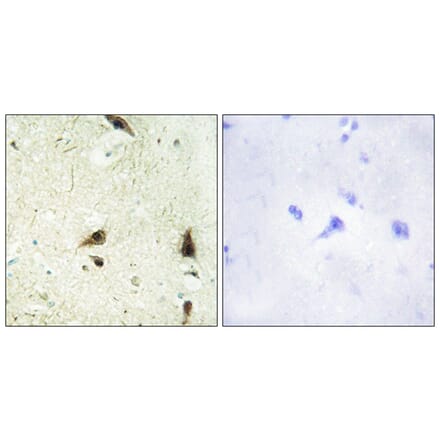 Immunohistochemistry - Anti-CHRC1 Antibody (C11750) - Antibodies.com