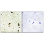 Immunohistochemistry - Anti-CHRC1 Antibody (C11750) - Antibodies.com